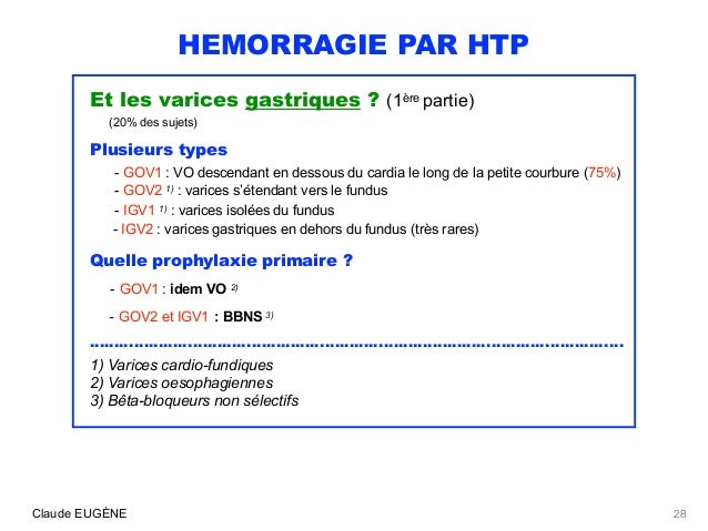 varices oesophagiennes traitement varices oesophagiennes traitement